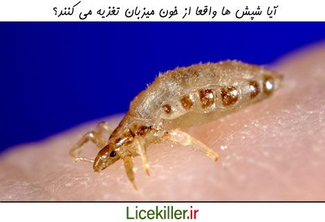 شپش ها واقعا خون پوست سر را می خورند؟